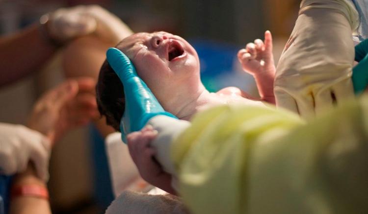 asfissia neonatale risarcimento danni