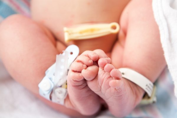 Idrocefalo neonatale