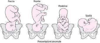 Danni da Travaglio Prolungato: Guida ai Diritti dei Pazienti 