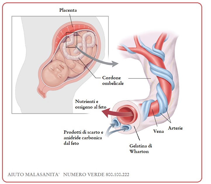 Cordone Ombelicale Nasconde Complicanze: i Rischi del Nodo Vero
