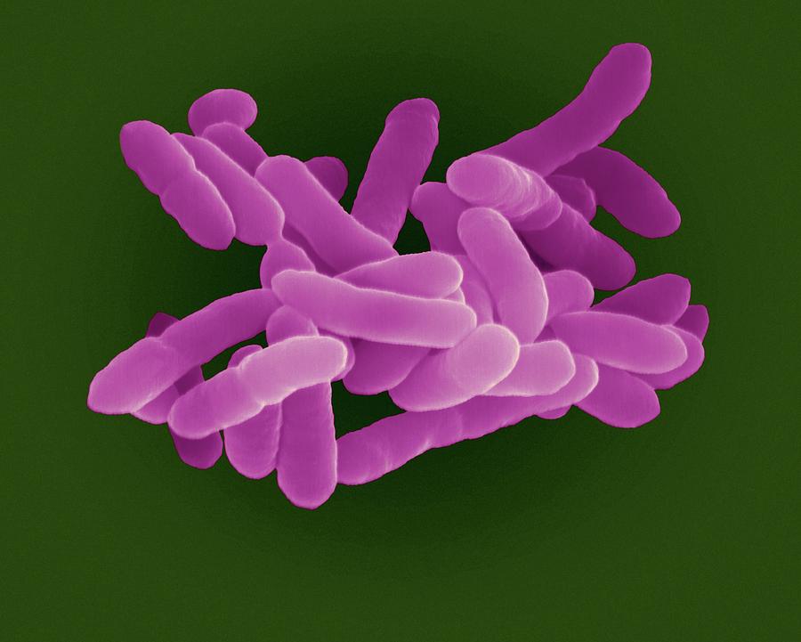 Scopri cosa fare se hai contratto un'infezione da Klebsiella pneumoniae in ospedale e quali sono le tue opzioni per ottenere un risarcimento danni.