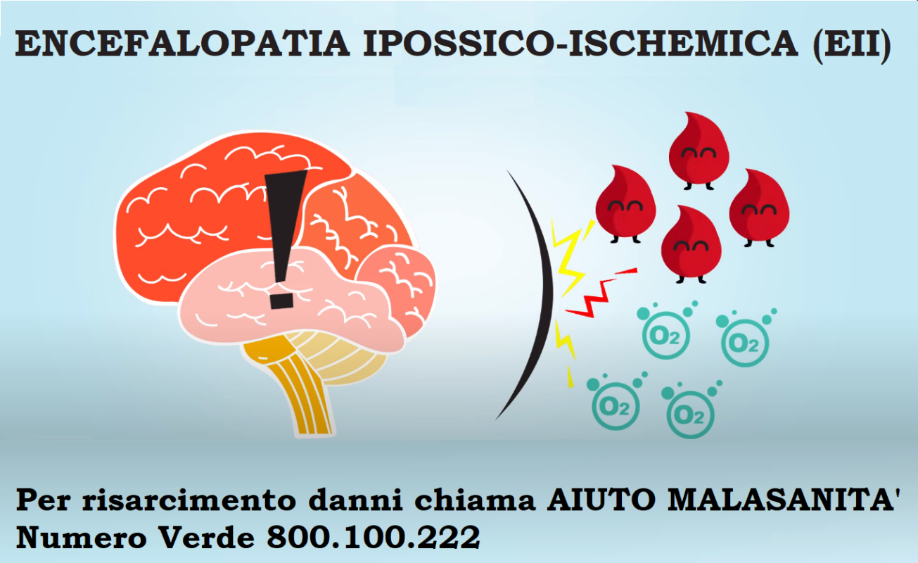 Encefalopatia ipossico ischemica
