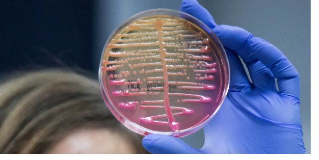 infezioni da Klebsiella e risarcimento danni