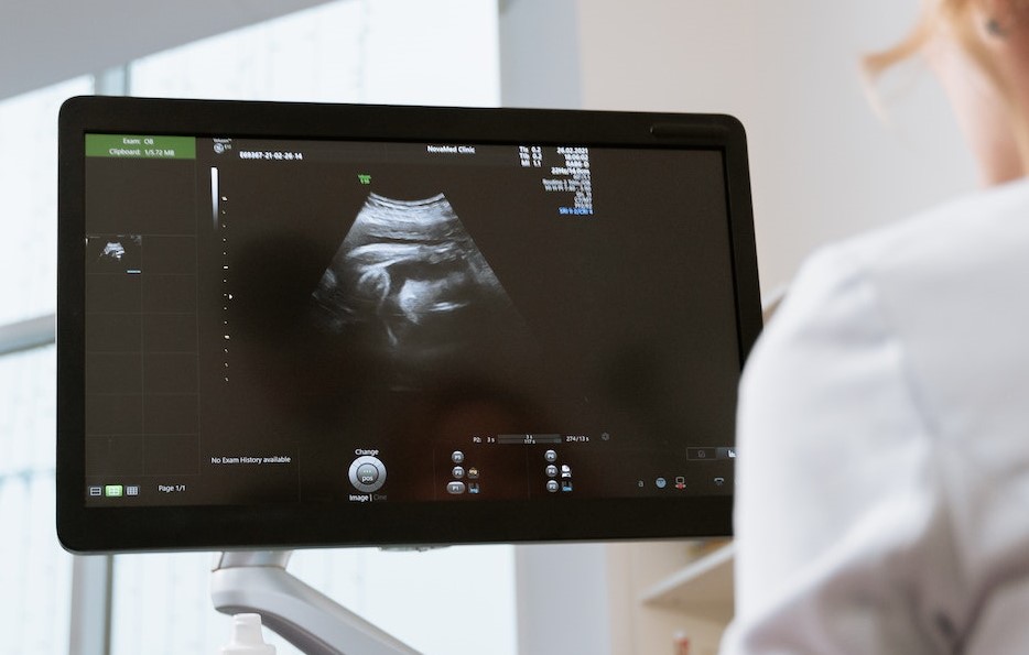 Errore medico in ginecologia