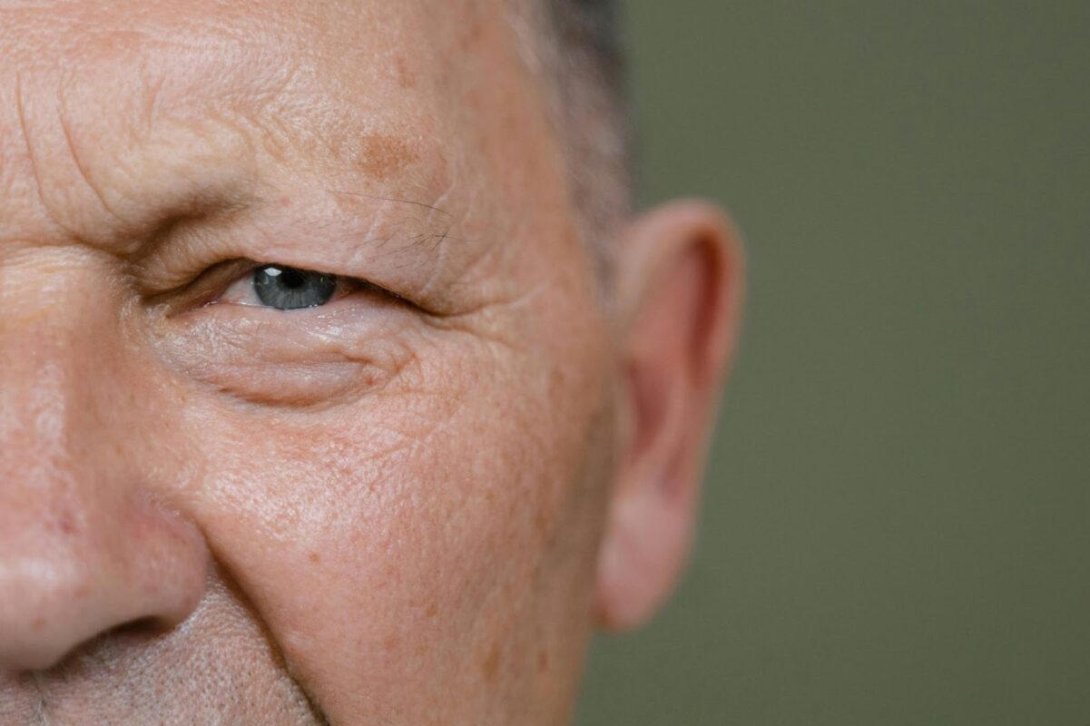 Intervento di cataratta e risarcimento